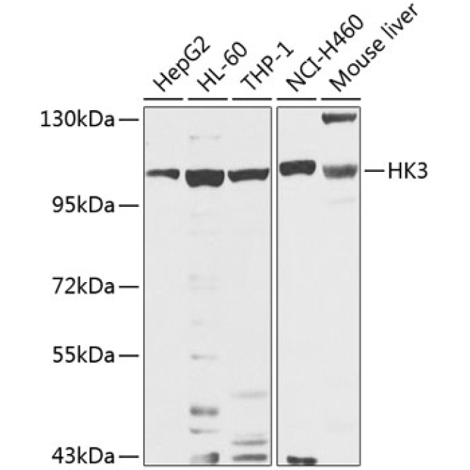 HK3 Rabbit Polyclonal Antibody