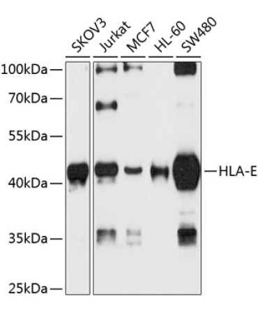 HLA-E Rabbit Polyclonal Antibody