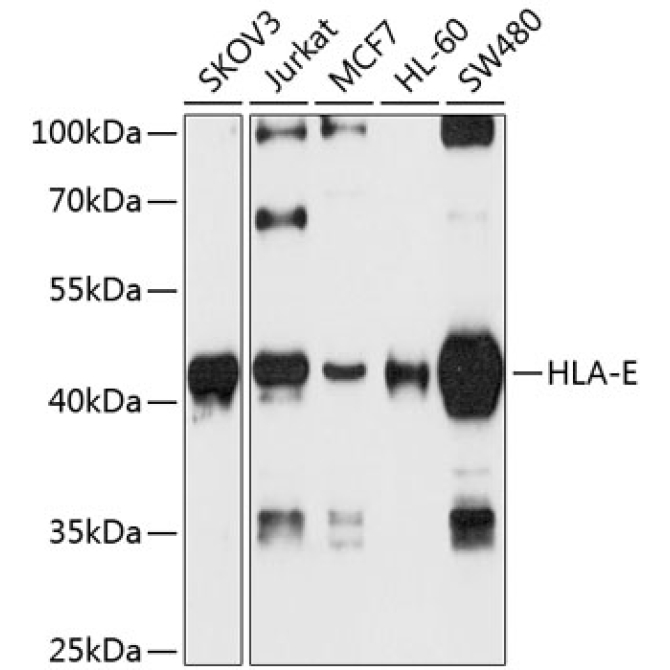 HLA-E Rabbit Polyclonal Antibody