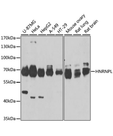 HNRNPL Rabbit Polyclonal Antibody