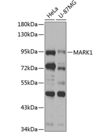 MARK1 Rabbit Polyclonal Antibody