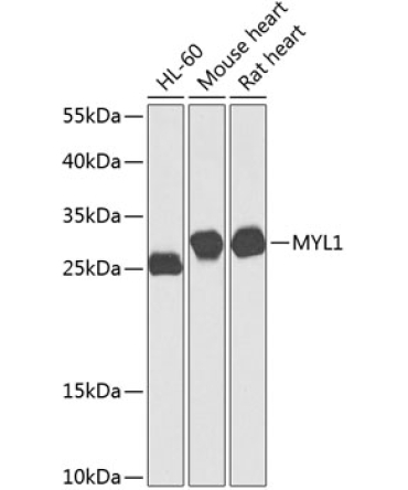 MYL1 Rabbit Polyclonal Antibody