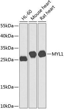 MYL1 Rabbit Polyclonal Antibody