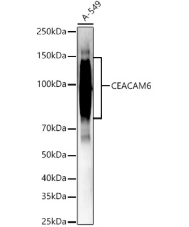 CEACAM6 Rabbit Polyclonal Antibody