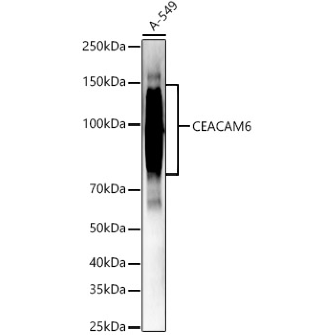 CEACAM6 Rabbit Polyclonal Antibody