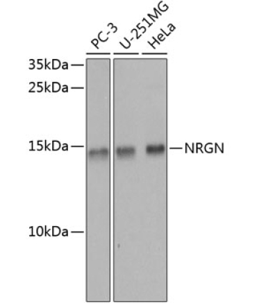 NRGN Rabbit Polyclonal Antibody