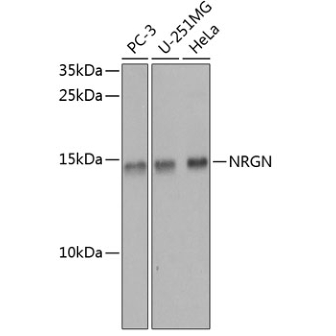 NRGN Rabbit Polyclonal Antibody
