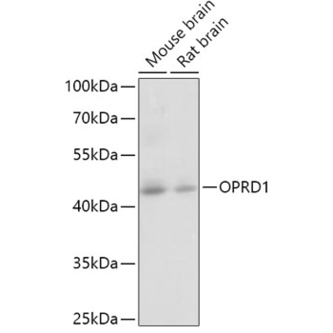 OPRD1 Rabbit Polyclonal Antibody