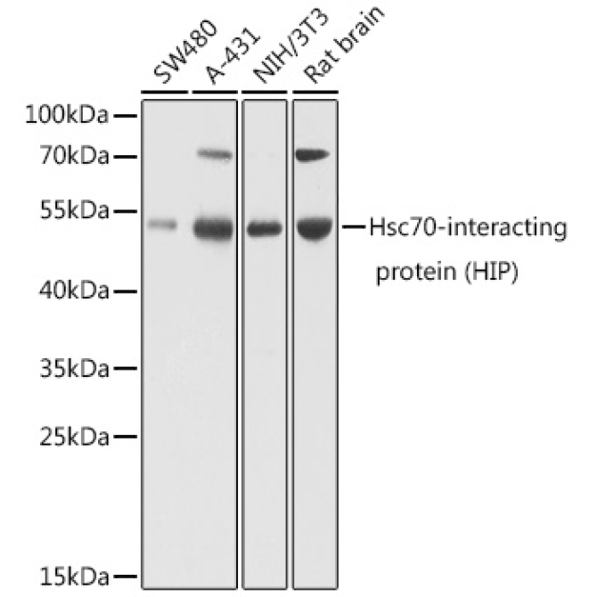 Hsc70-interacting protein (HIP) Rabbit Polyclonal Antibody