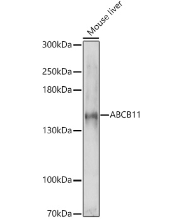 ABCB11 Rabbit Polyclonal Antibody