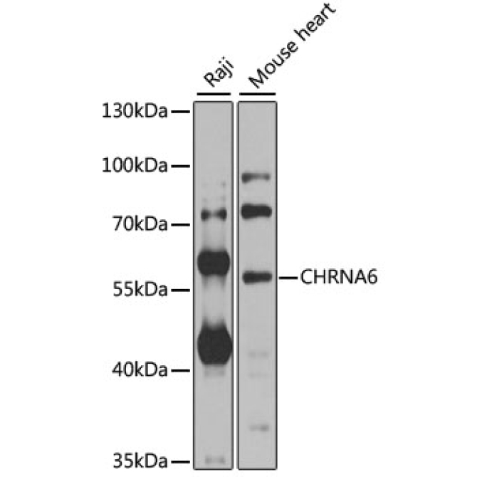 CHRNA6 Rabbit Polyclonal Antibody