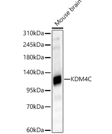 KDM4C Rabbit Polyclonal Antibody