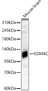 KDM4C Rabbit Polyclonal Antibody