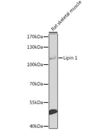 Lipin 1 Rabbit Polyclonal Antibody