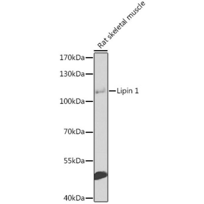 Lipin 1 Rabbit Polyclonal Antibody