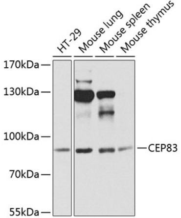 CEP83 Rabbit Polyclonal Antibody