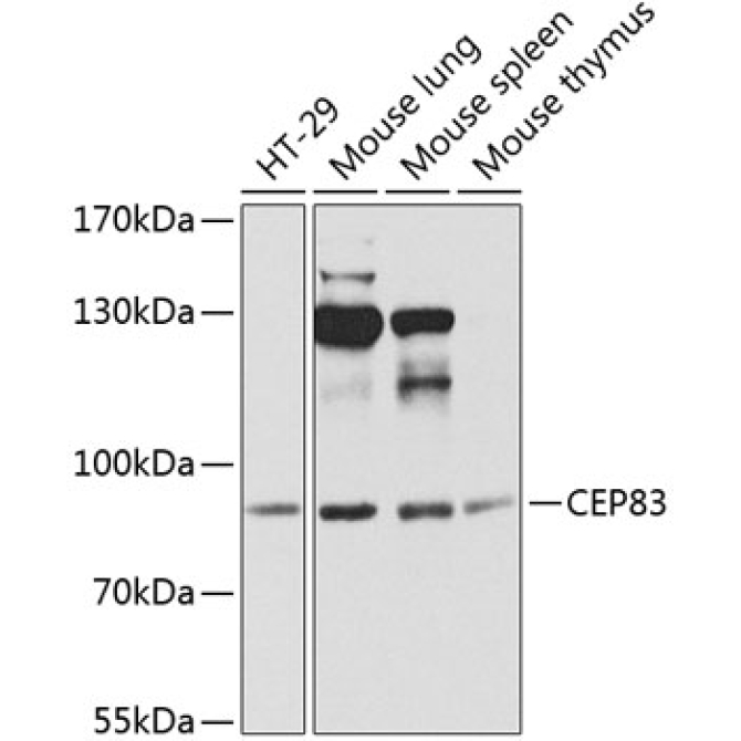 CEP83 Rabbit Polyclonal Antibody