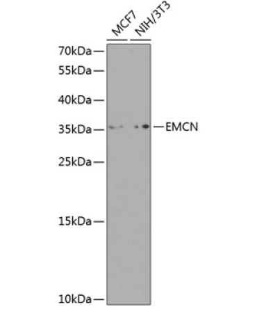Endomucin Rabbit Polyclonal Antibody