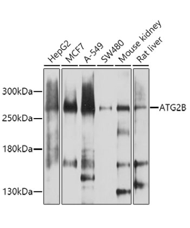 ATG2B Rabbit Polyclonal Antibody