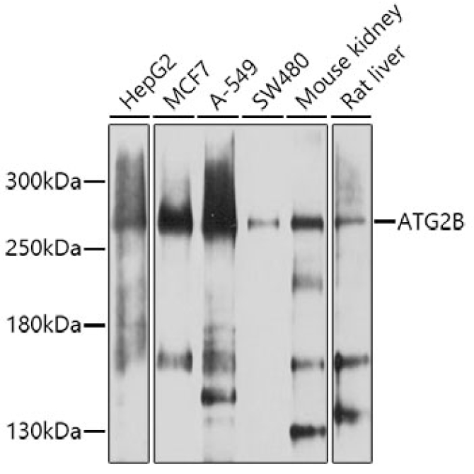 ATG2B Rabbit Polyclonal Antibody