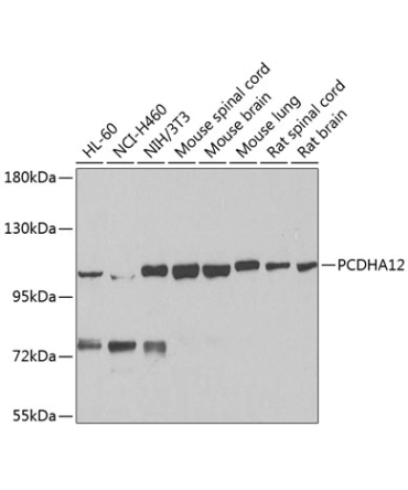PCDHA12 Rabbit Polyclonal Antibody
