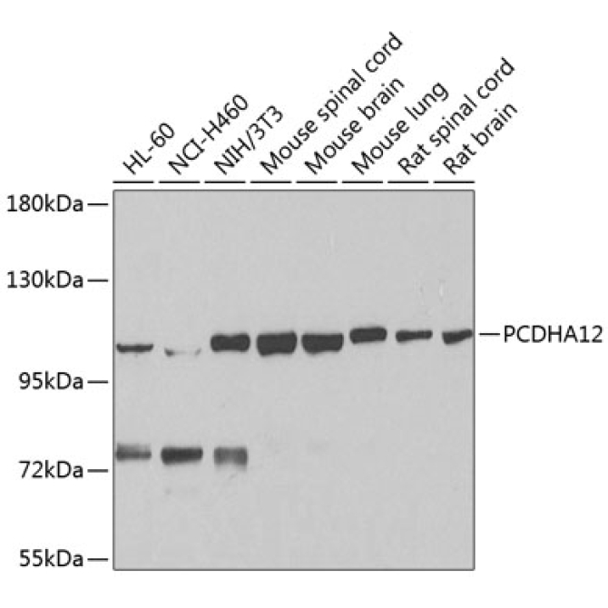 PCDHA12 Rabbit Polyclonal Antibody