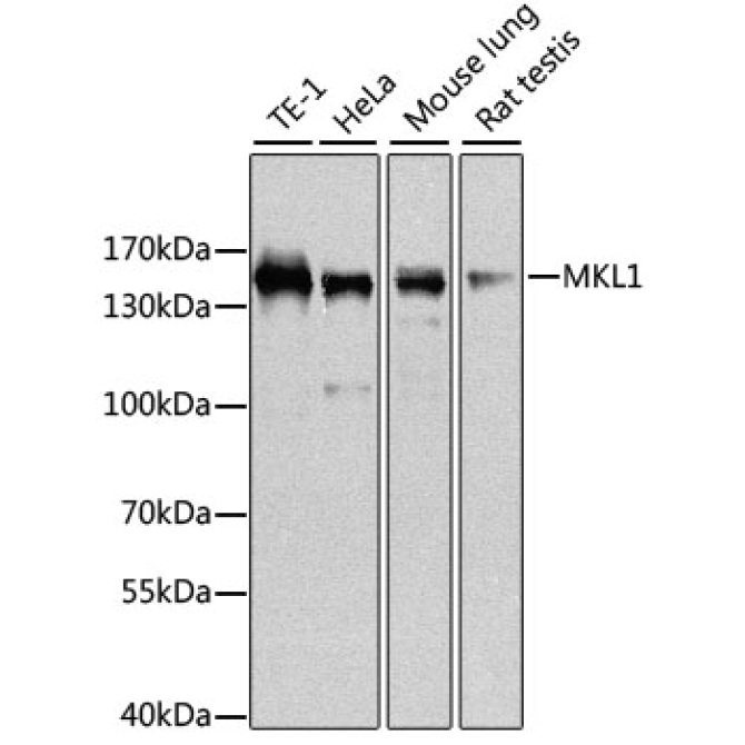 MKL1 Rabbit Polyclonal Antibody