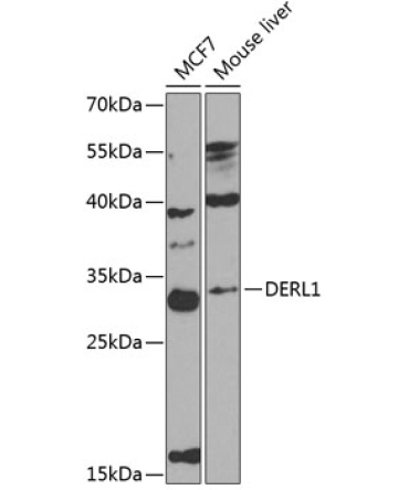 DERL1 Rabbit Polyclonal Antibody