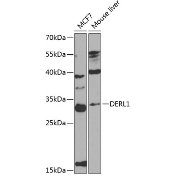 DERL1 Rabbit Polyclonal Antibody