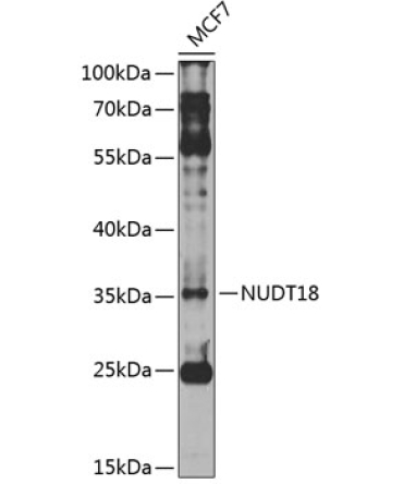 NUDT18 Rabbit Polyclonal Antibody