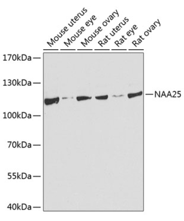 NAA25 Rabbit Polyclonal Antibody