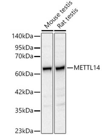 METTL14 Rabbit Polyclonal Antibody