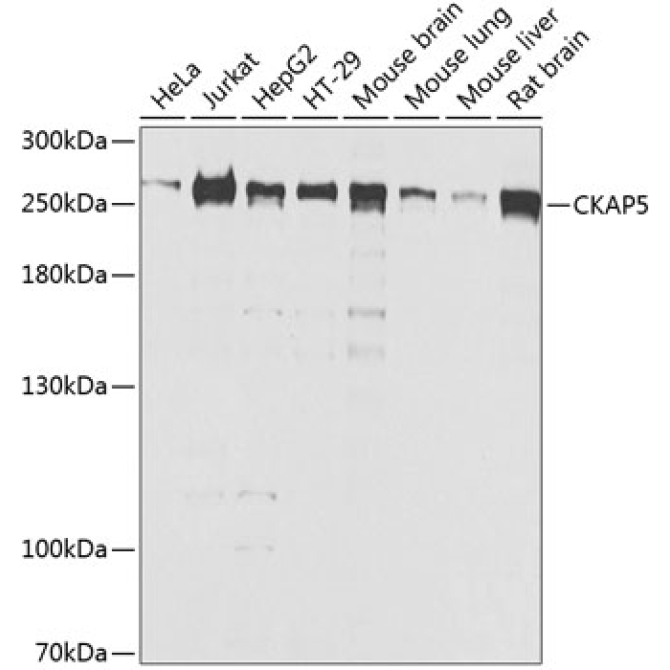 CKAP5 Rabbit Polyclonal Antibody