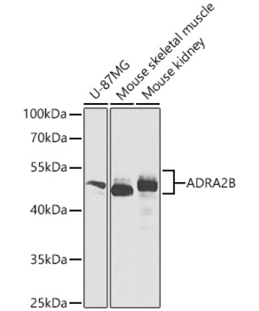 ADRA2B Rabbit Polyclonal Antibody