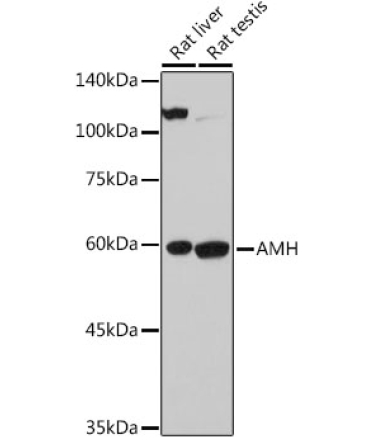AMH Rabbit Polyclonal Antibody