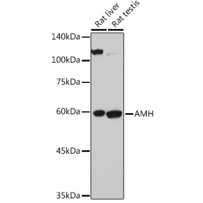 AMH Rabbit Polyclonal Antibody