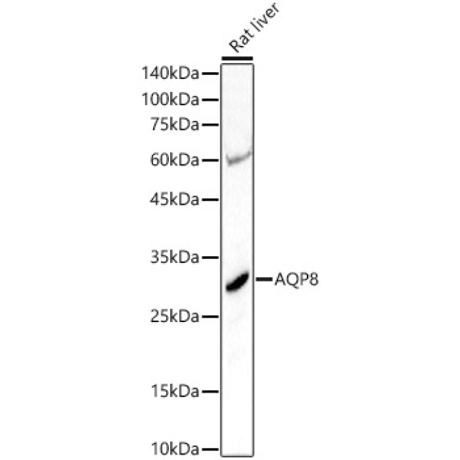 AQP8 Rabbit Polyclonal Antibody