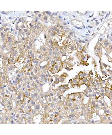 AQP9 Rabbit Polyclonal Antibody