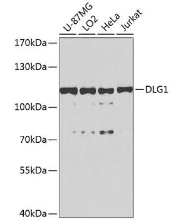 DLG1 Rabbit Polyclonal Antibody