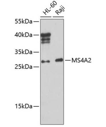 MS4A2 Rabbit Polyclonal Antibody