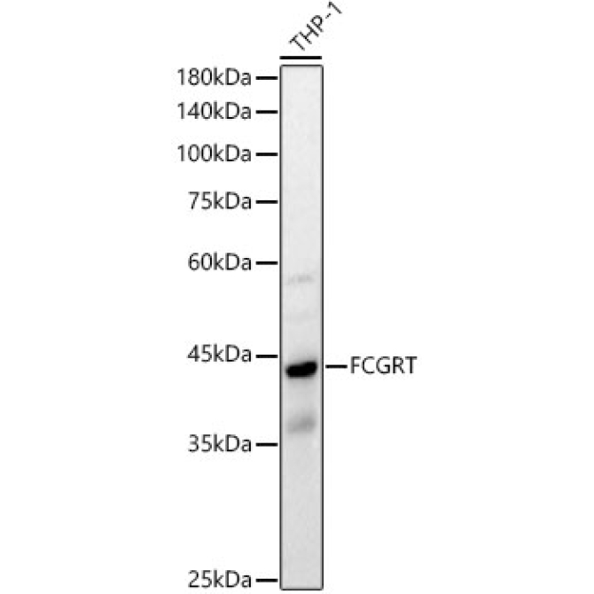 FCGRT Rabbit Polyclonal Antibody