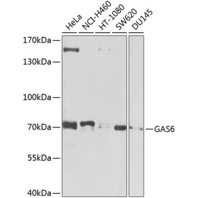 GAS6 Rabbit Polyclonal Antibody