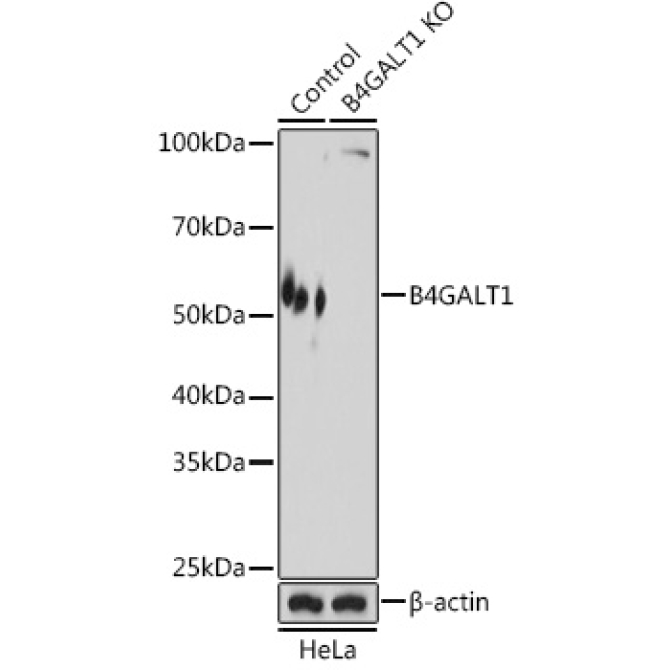 B4GALT1 Rabbit Polyclonal Antibody [KO Validated]