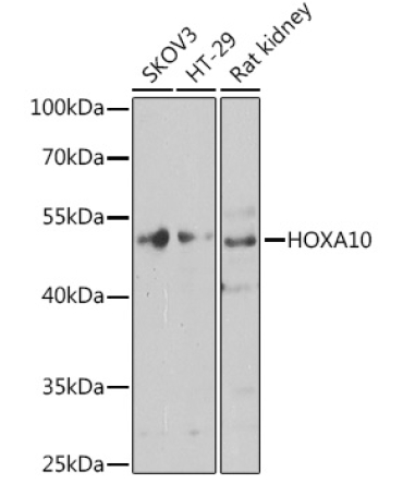HOXA10 Rabbit Polyclonal Antibody
