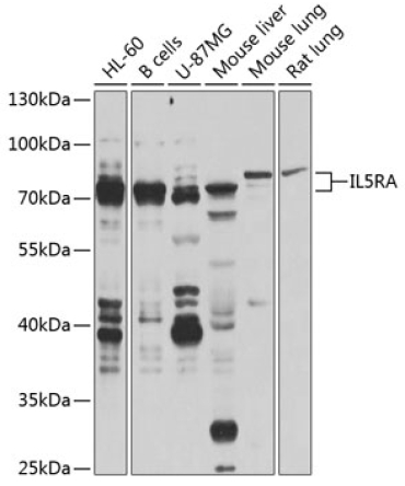 IL5RA Rabbit Polyclonal Antibody