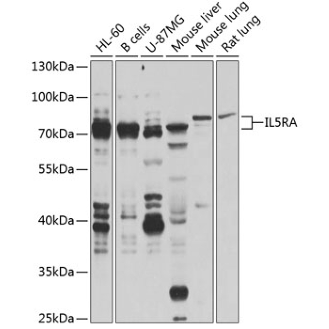 IL5RA Rabbit Polyclonal Antibody