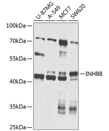 INHBB Rabbit Polyclonal Antibody