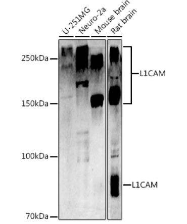 CD171/L1CAM Rabbit Polyclonal Antibody