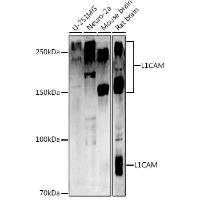 CD171/L1CAM Rabbit Polyclonal Antibody