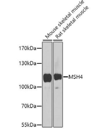 MSH4 Rabbit Polyclonal Antibody